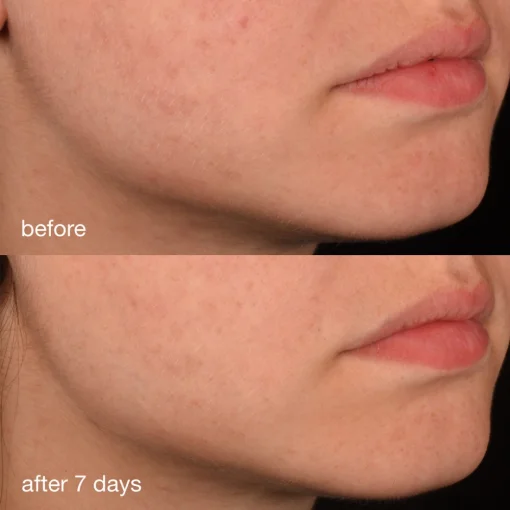 Антиоксидантна сироватка з колагеном Dermalogica Pro-Collagen Banking Serum, 30мл